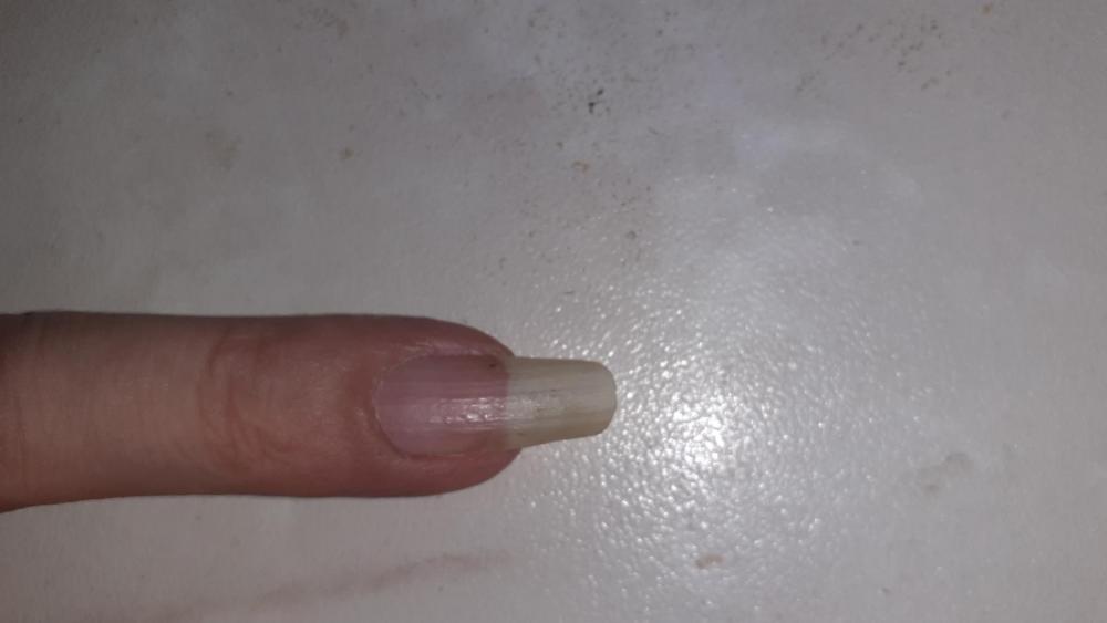 Fingernagel.jpg